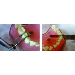 C3-11, Geared Angle Handpiece - Kit